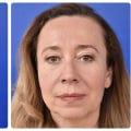 A Comprehensive Look at Brow Lift Surgery
