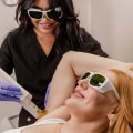 The Ultimate Guide to Laser Hair Removal
