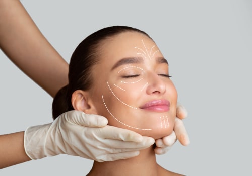 Understanding the Facelift Procedure